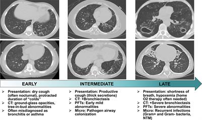 An AIREless Breath: Pneumonitis Caused by Impaired Central Immune Tolerance